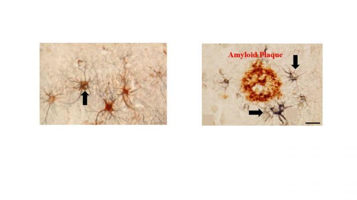 科學(xué)家發(fā)現(xiàn)可能用于早期檢測阿爾茨海默氏病的新型PET示蹤劑