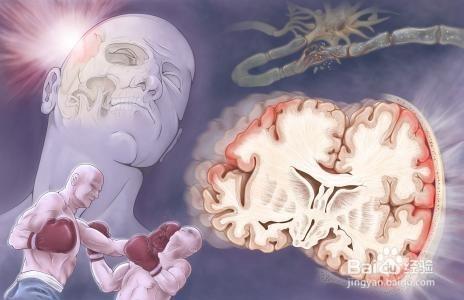 科學家確定了將創(chuàng)傷性腦損傷與神經退行性疾病聯(lián)系起來的機制