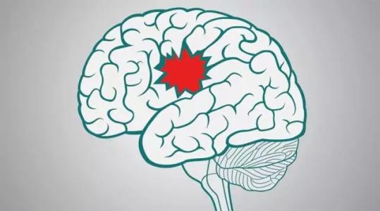 研究人員獲得了對自閉癥和中風(fēng)的新見解