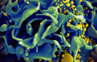 免疫療法組合可在HIV模型中實現儲庫縮小
