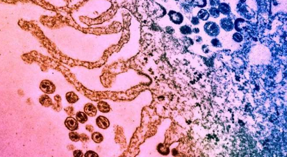抗生素分子可使免疫系統殺死感染HIV的細胞