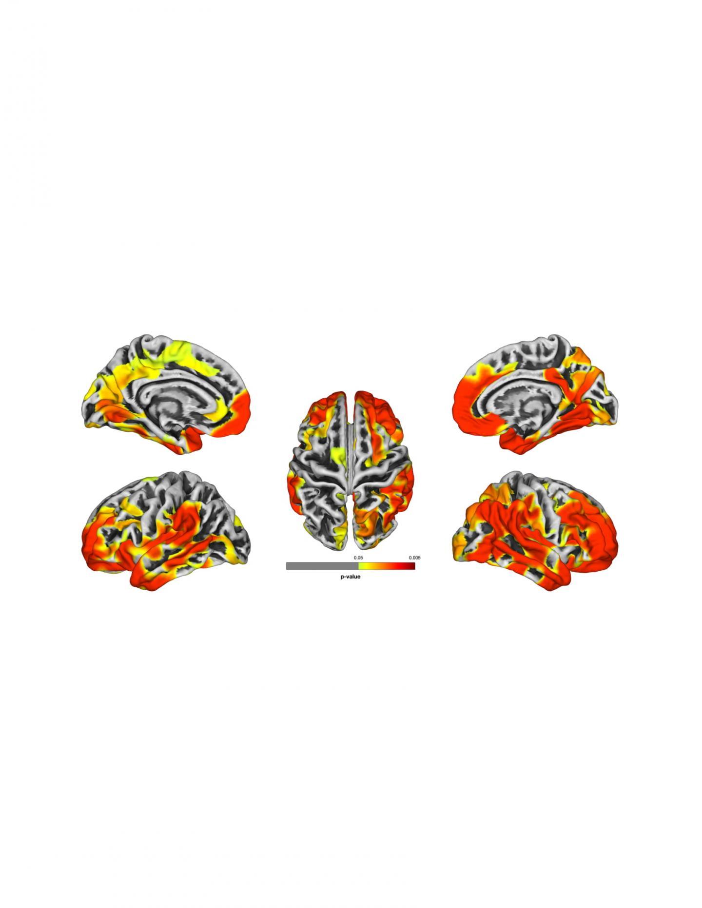 研究表明進(jìn)一步的證據(jù)表明世貿(mào)中心反應(yīng)者存在癡呆癥風(fēng)險