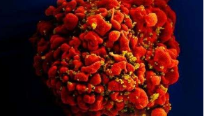 干細胞移植后再次感染HIV的重要窗口