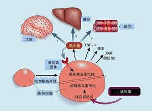 研究表明 更年期會(huì)增加代謝綜合征的風(fēng)險(xiǎn)
