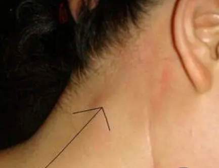研究人員獲得 300 萬(wàn)美元用于改善淋巴水腫護(hù)理服務(wù)的研究
