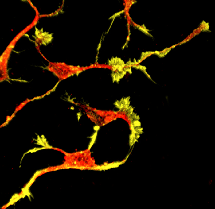 科學家發(fā)現高危自閉癥基因缺陷導致的生物學機制