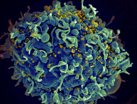 抗體療法在新的臨床試驗中控制 HIV 數月