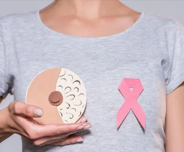 科學(xué)家在乳腺癌中發(fā)現(xiàn)了一種新的耐藥機制