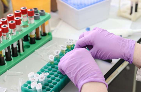 尿液碳酸氫鹽檢測為囊性纖維化患者的 CFTR 功能提供了新的安全的量化方法