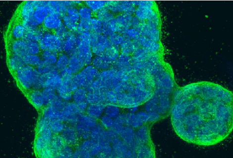 新研究闡明了由 BRCA 突變引起的癌癥復發(fā)的原因