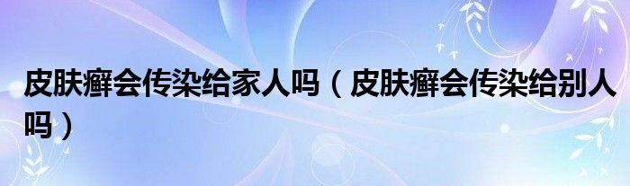 皮膚癬會(huì)傳染給家人嗎（皮膚癬會(huì)傳染給別人嗎）