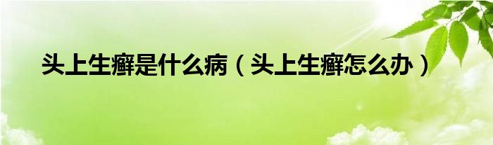 頭上生癬是什么?。^上生癬怎么辦）