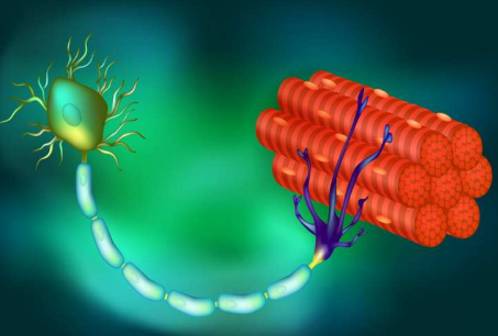 DNA 治療可以延緩幾乎所有 ALS 患者的癱瘓