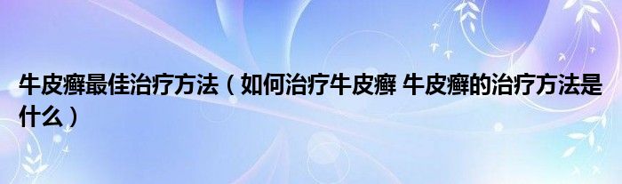 牛皮癬最佳治療方法（如何治療牛皮癬 牛皮癬的治療方法是什么）