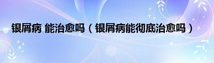 銀屑病 能治愈嗎（銀屑病能徹底治愈嗎）