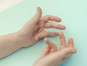 研究發(fā)現(xiàn)不同掌腱膜攣縮癥治療的初步結果具有可比性