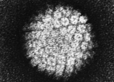 HPV 相關(guān)頭頸癌放射治療新指南