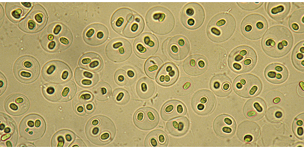 人工甜味劑可能會對微生物造成嚴(yán)重破壞