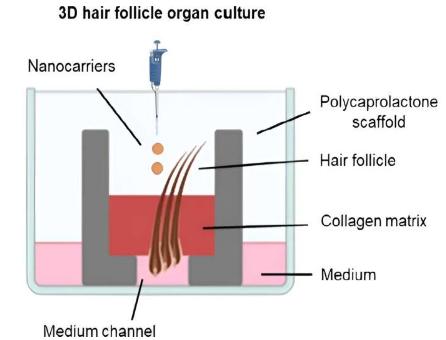 研究人員開發(fā)出 3D 打印模型，用于針對毛囊感染的靶向抗生素治療