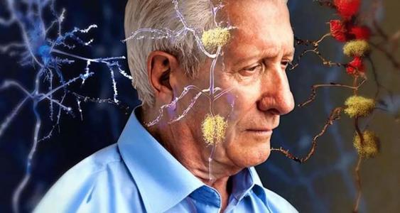研究人員發(fā)現(xiàn)失去一夜的睡眠可能會增加阿爾茨海默氏癥的生物標(biāo)志物