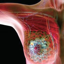 研究人員批評(píng)研究呼吁擴(kuò)大乳腺癌的基因檢測(cè)